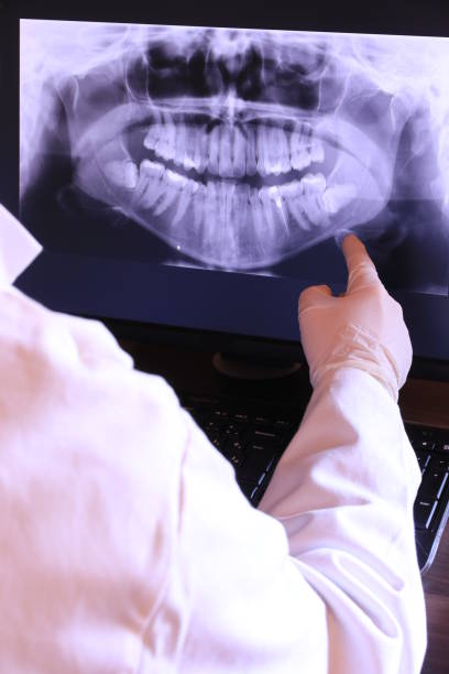 Best Emergency Root Canal Treatment in Schulenburg, TX